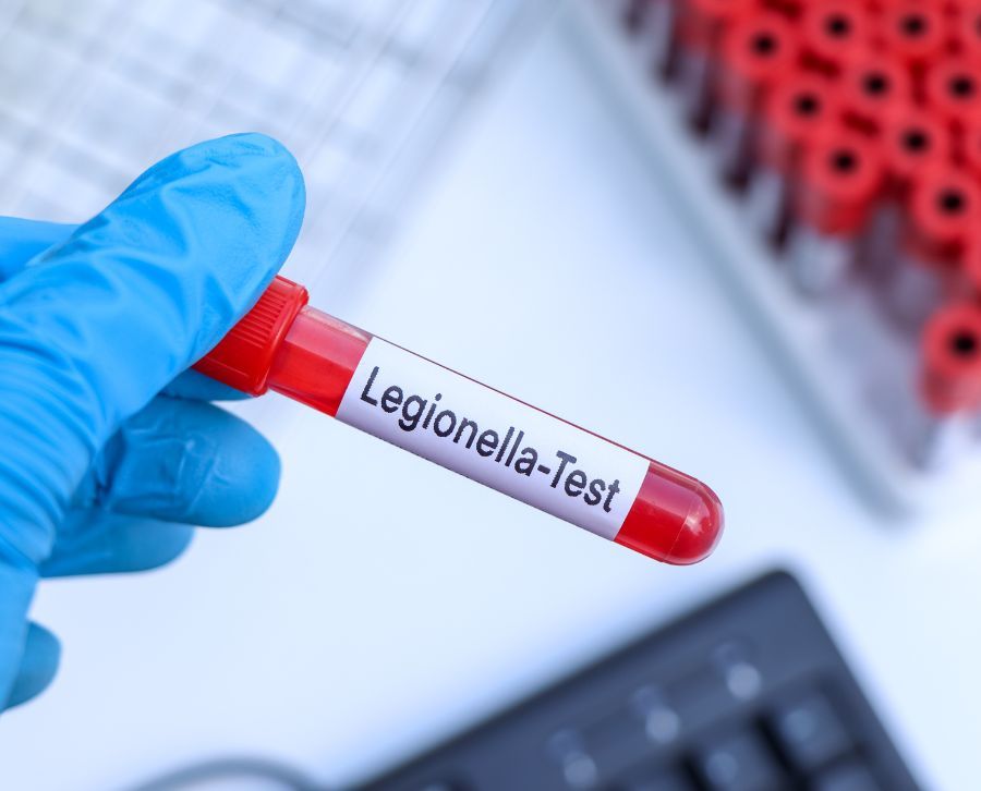 legionella